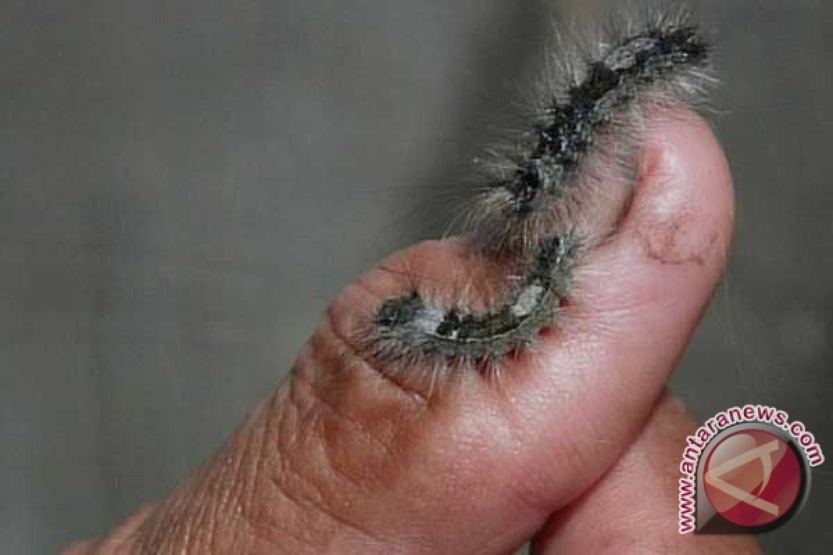 Seventy-one experts assigned to probe caterpillar infestation in Bali