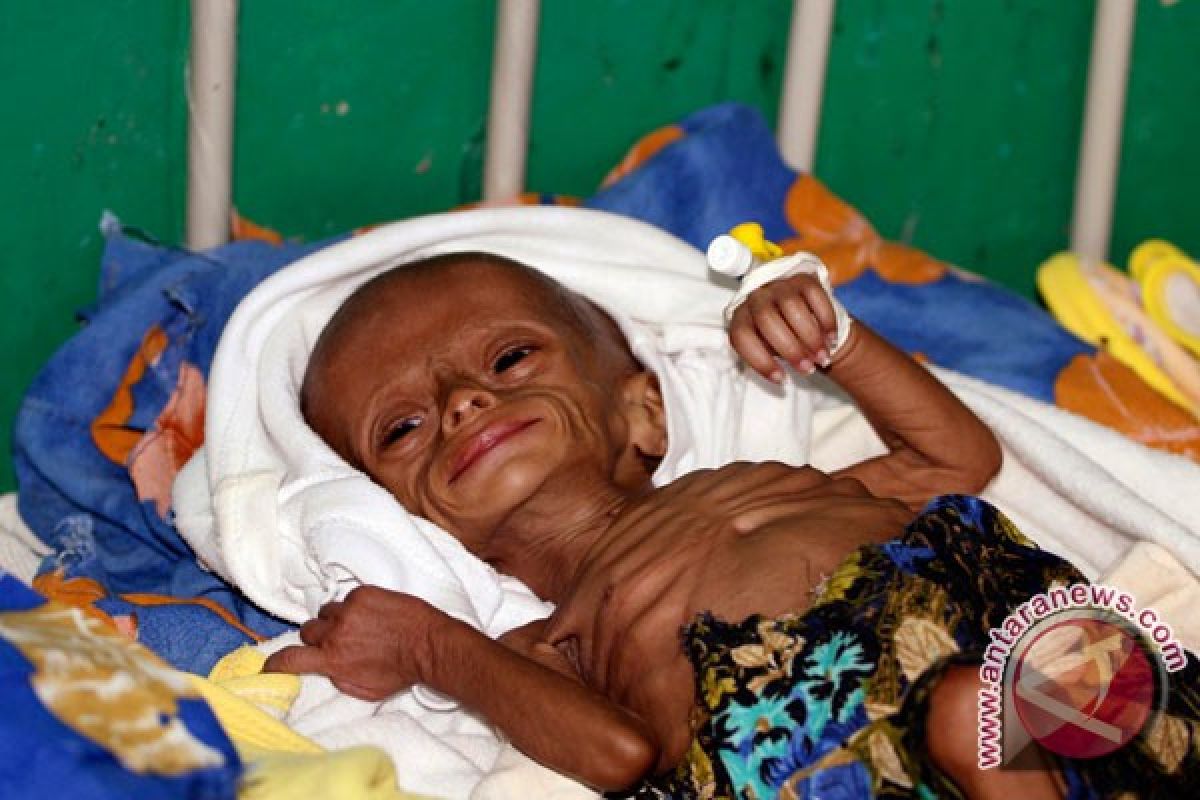 85,000 children may have died from famine in Yemen