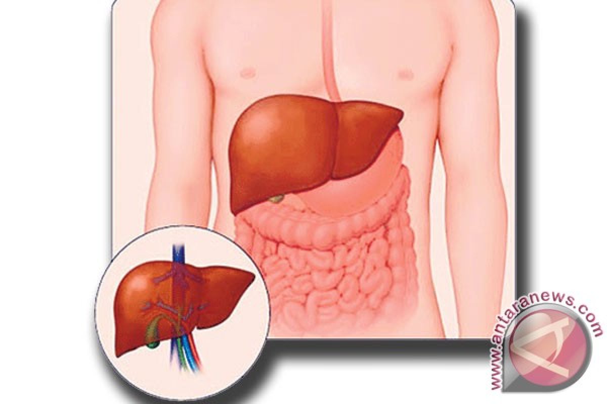 Dua miliar orang pernah terinfeksi hepatitis