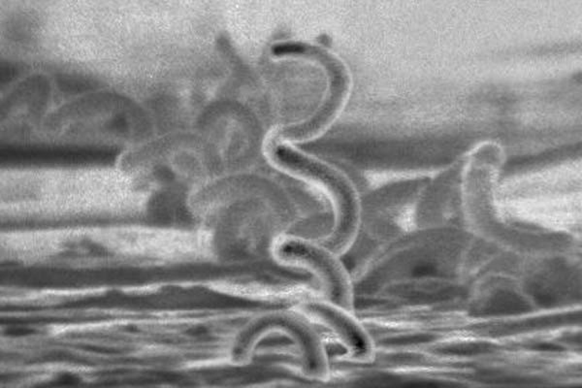 Sebanyak 122 Warga Riau terjangkit Sifilis, terbanyak di Dumai