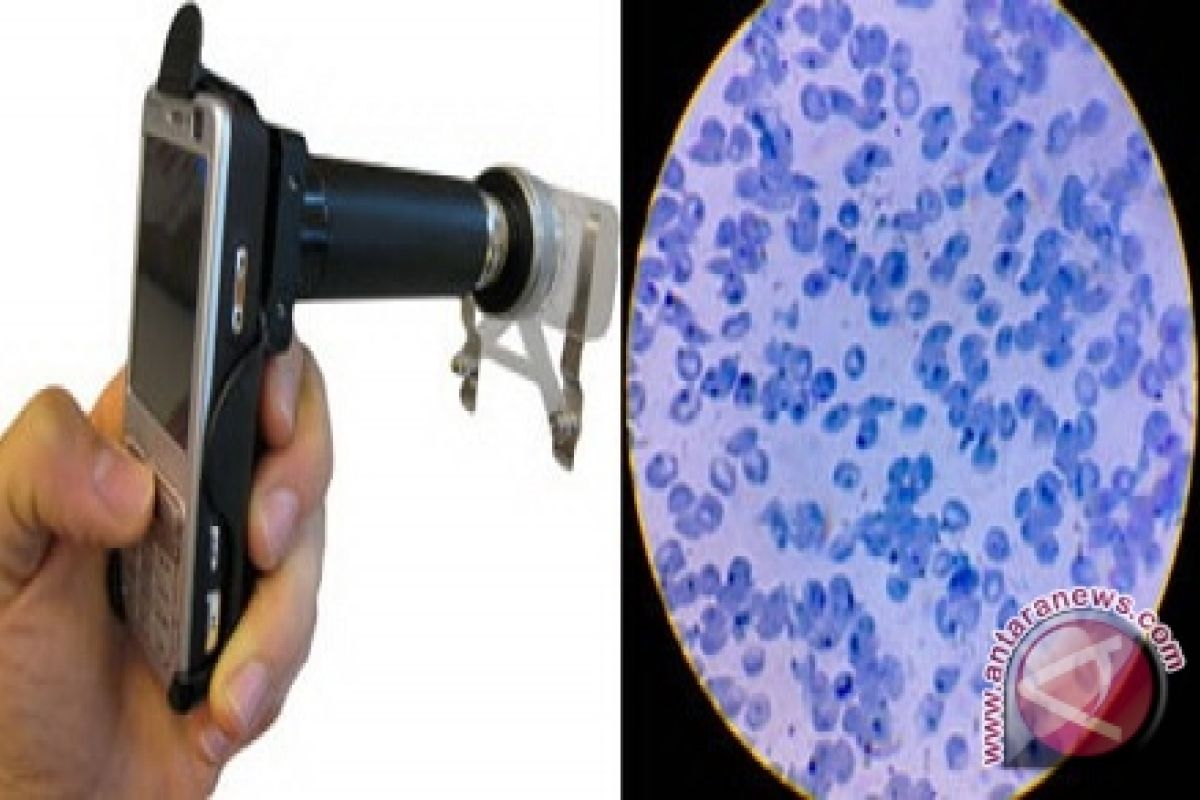 CellScope, Ponsel Pintar Mikroskop Guna Deteksi Penyakit