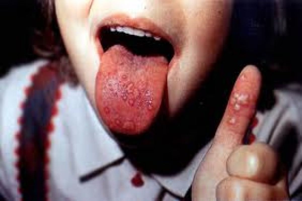 Foot-and-mouth disease confirmed in NW China