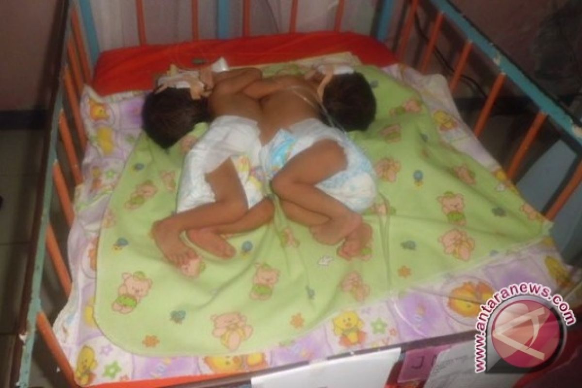 Bayi kembar siam meninggal di RSUD Bengkulu