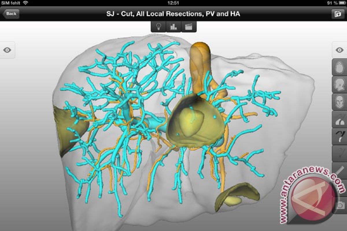 Dari The Tarix Jabrix ke proses stem cell