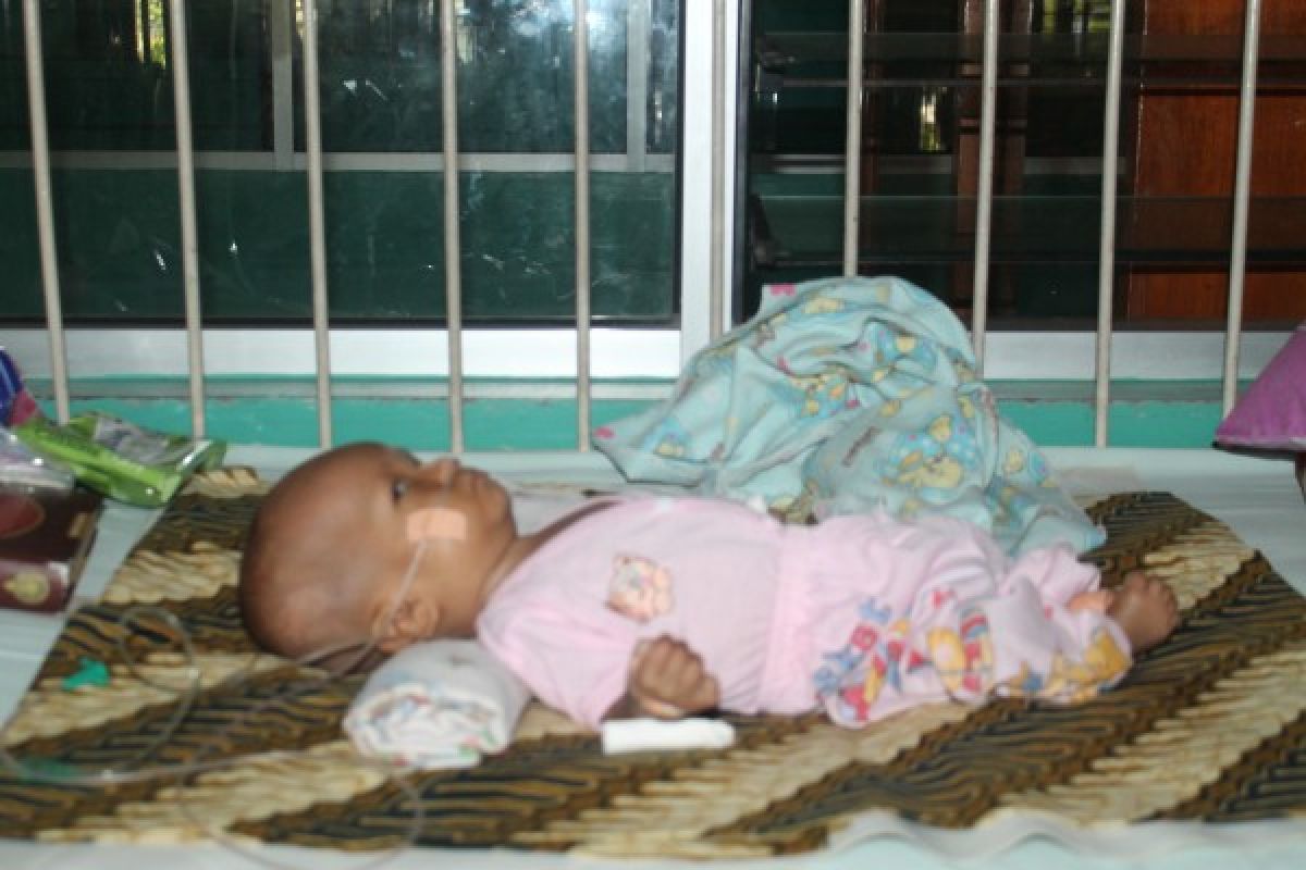 Hafizah, Bayi Hidrocefalus Operasi Hari ini