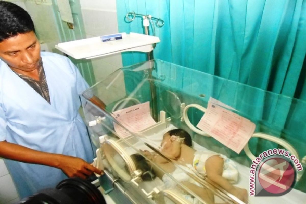 Bayi Kembar Siam Asal Kutai Akhirnya Meninggal 