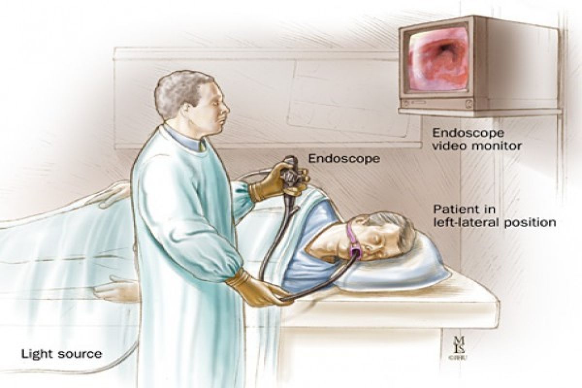 RSUD Optimalkan Peralatan Medis Endoscope pada 2014