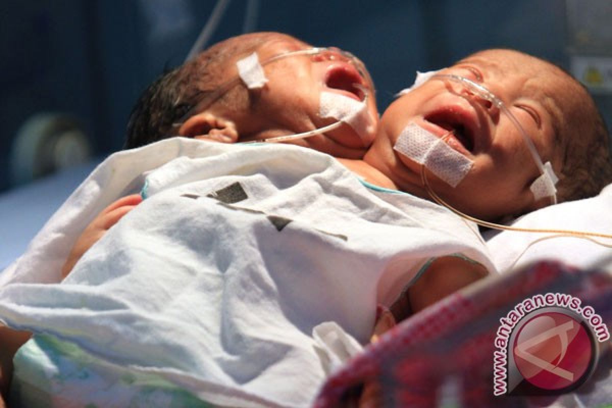 Bayi berkepala dua meninggal di Medan