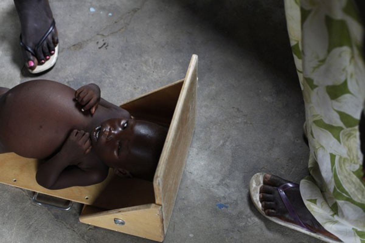 PBB: krisis pangan Sudan Selatan terburuk di dunia