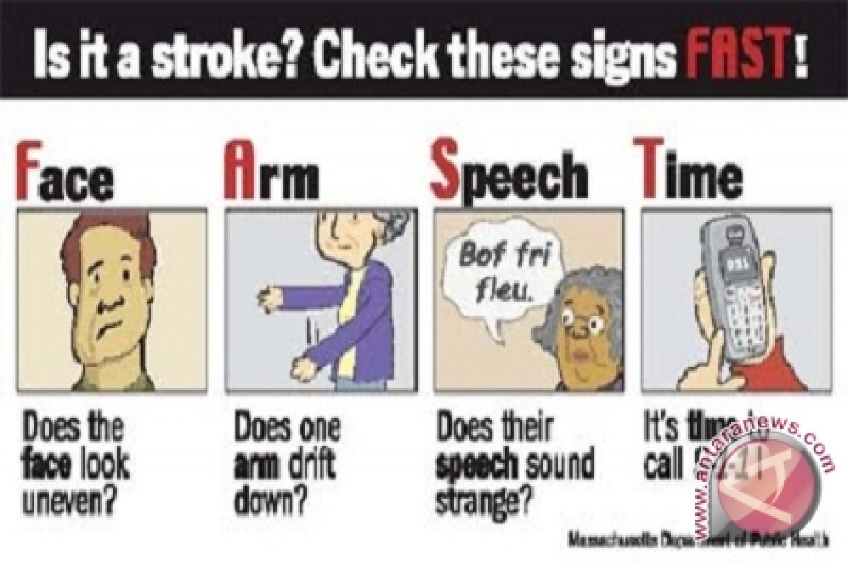 Pakar: Ketahui empat gejala umum stroke