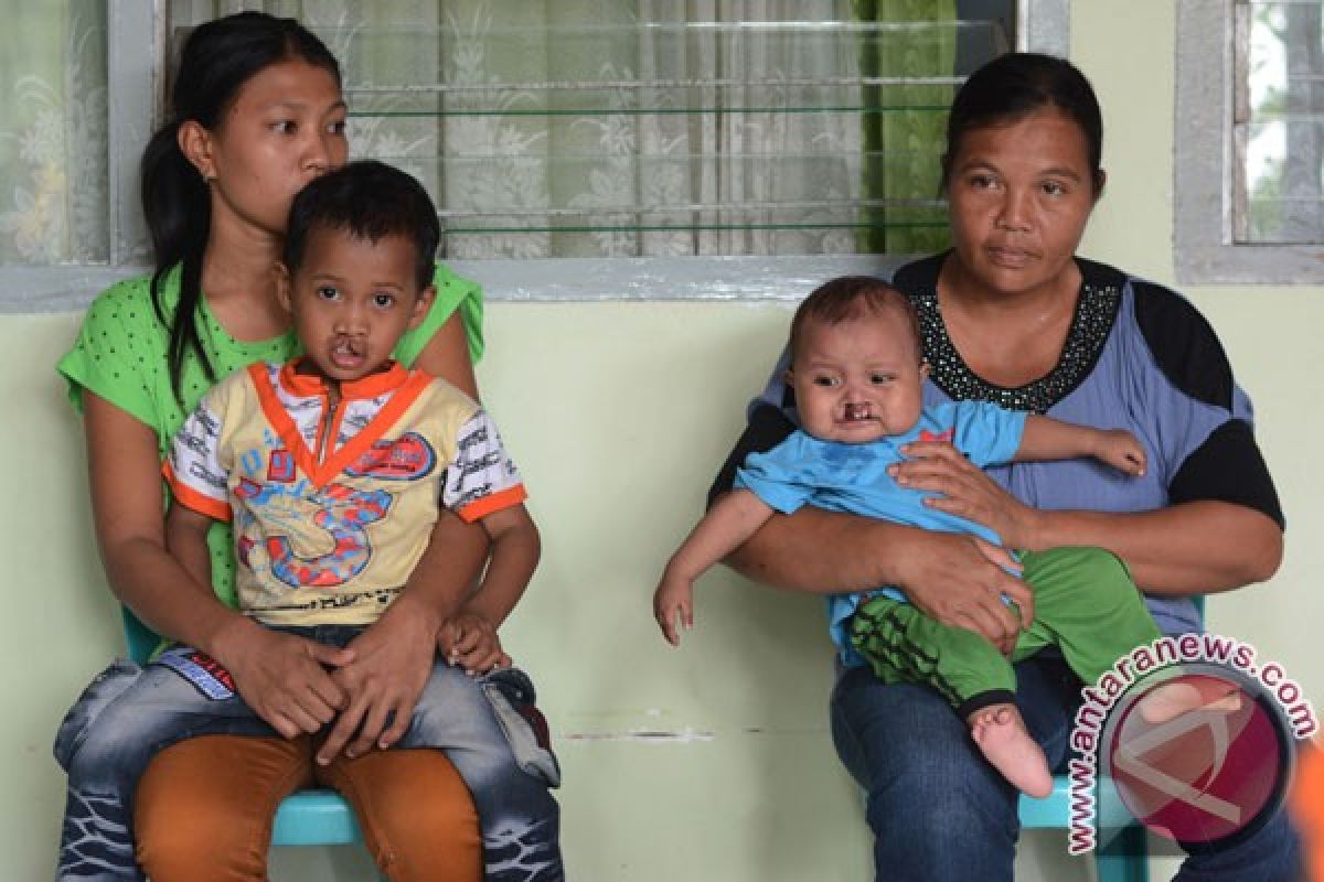 Agar bayi tak derita bibir sumbing, jaga nutrisi selama kehamilan