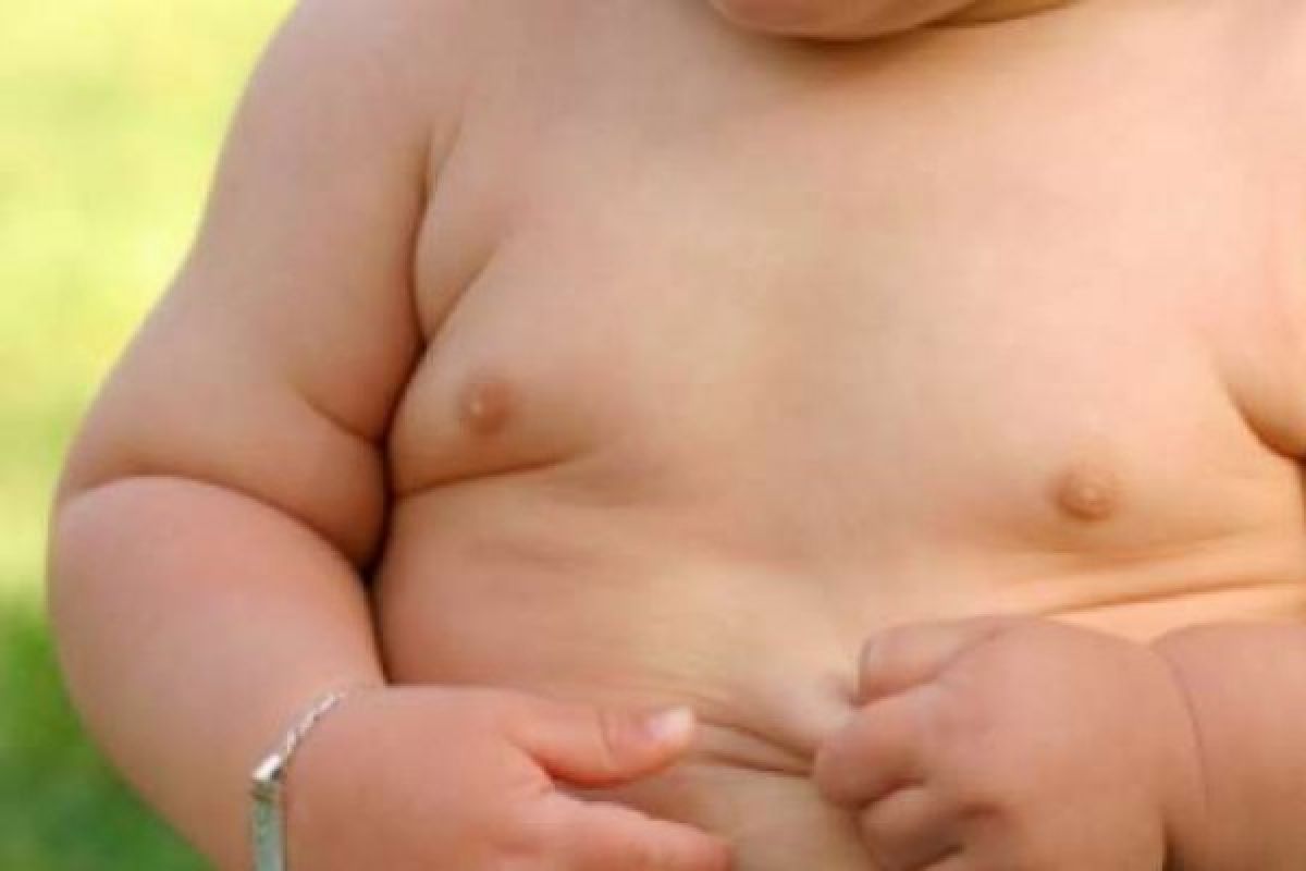 Jika Anak Anda Obesitas, Tangkis Dengan Cara Ini