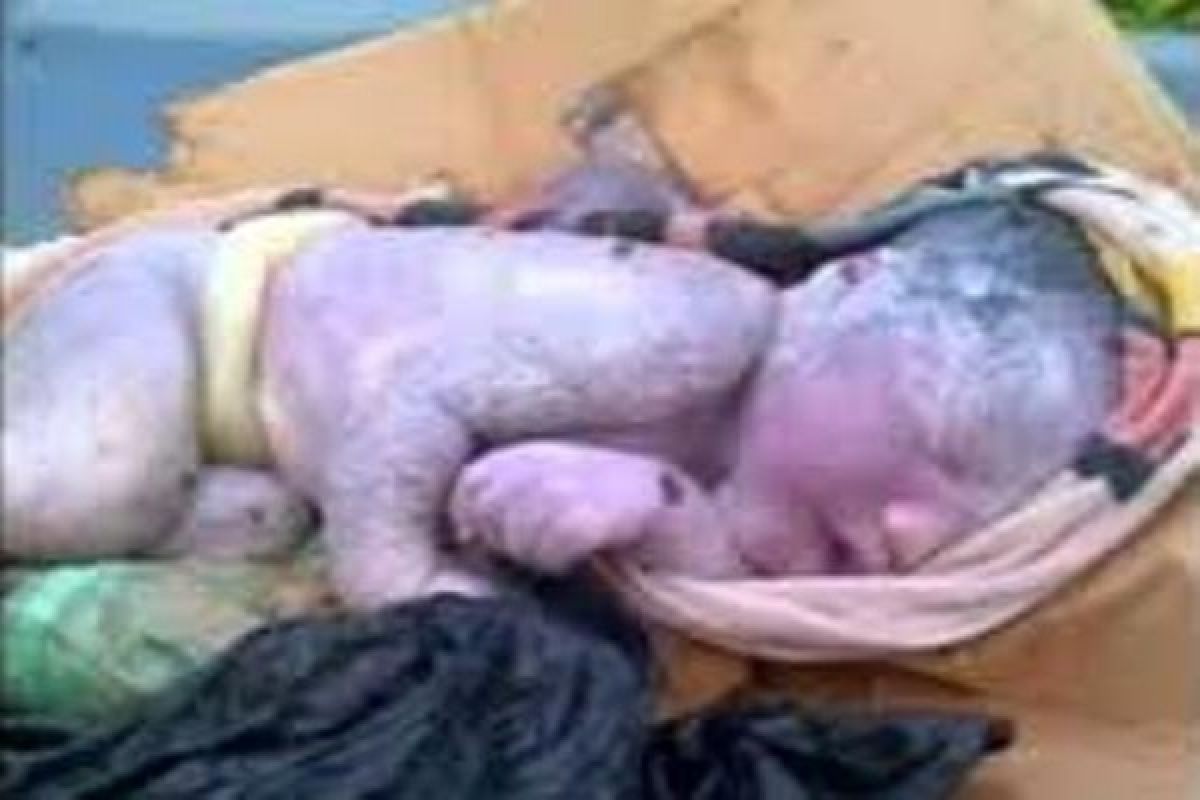 Bayi temuan warga Abepura akhirnya meninggal
