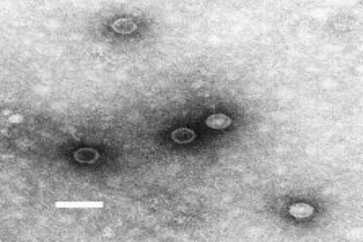 Penyakit Polio Kembali Mewabah Ke Eropa