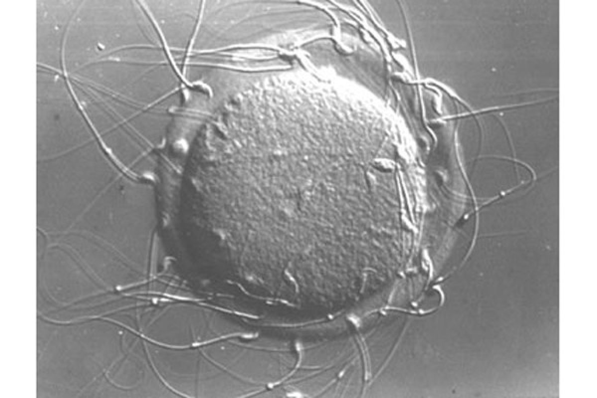 Ilmuwan buat sel sperma fungsional dari sel punca 