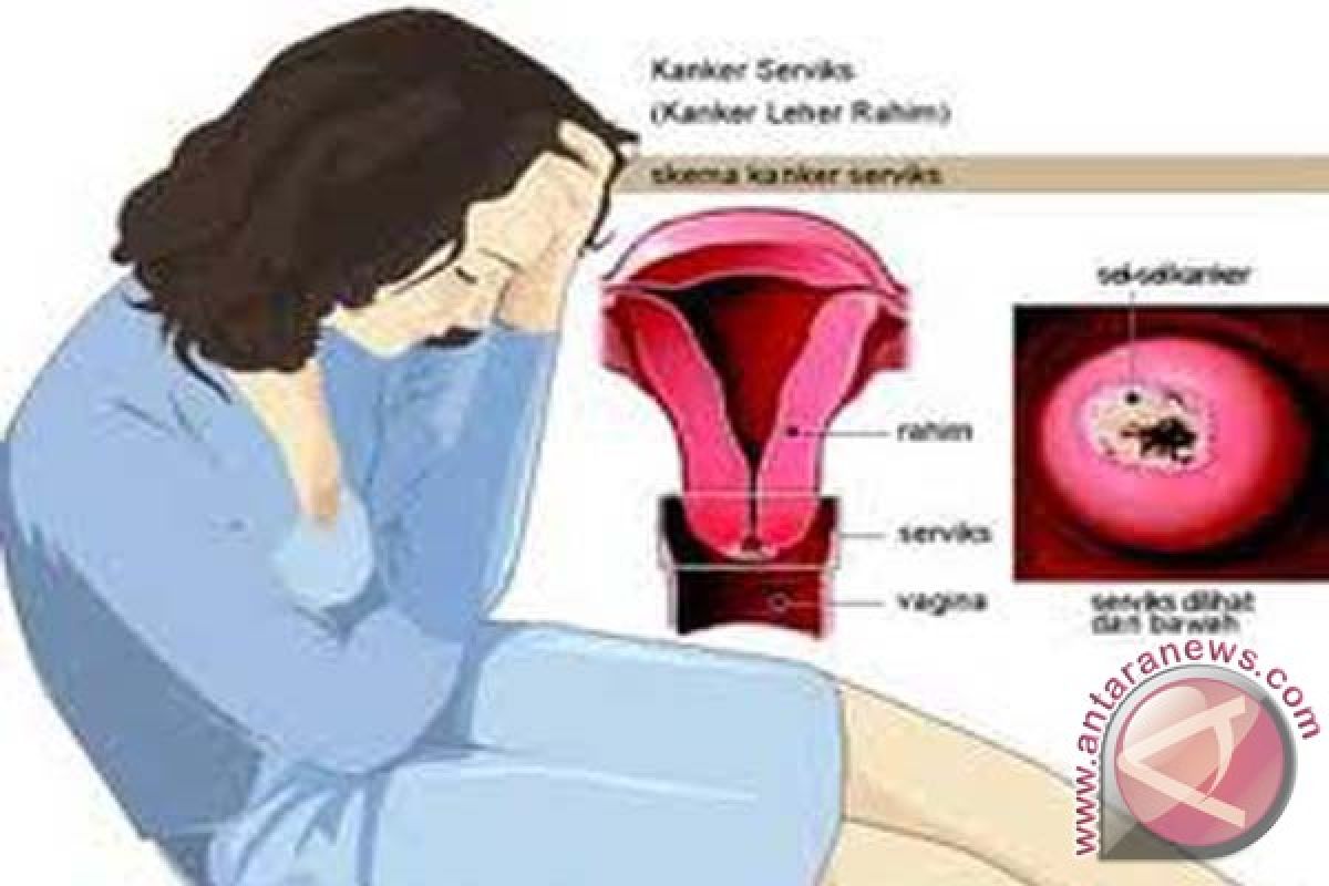 Ini Penyebab Kanker Serviks dan Faktor Risikonya  