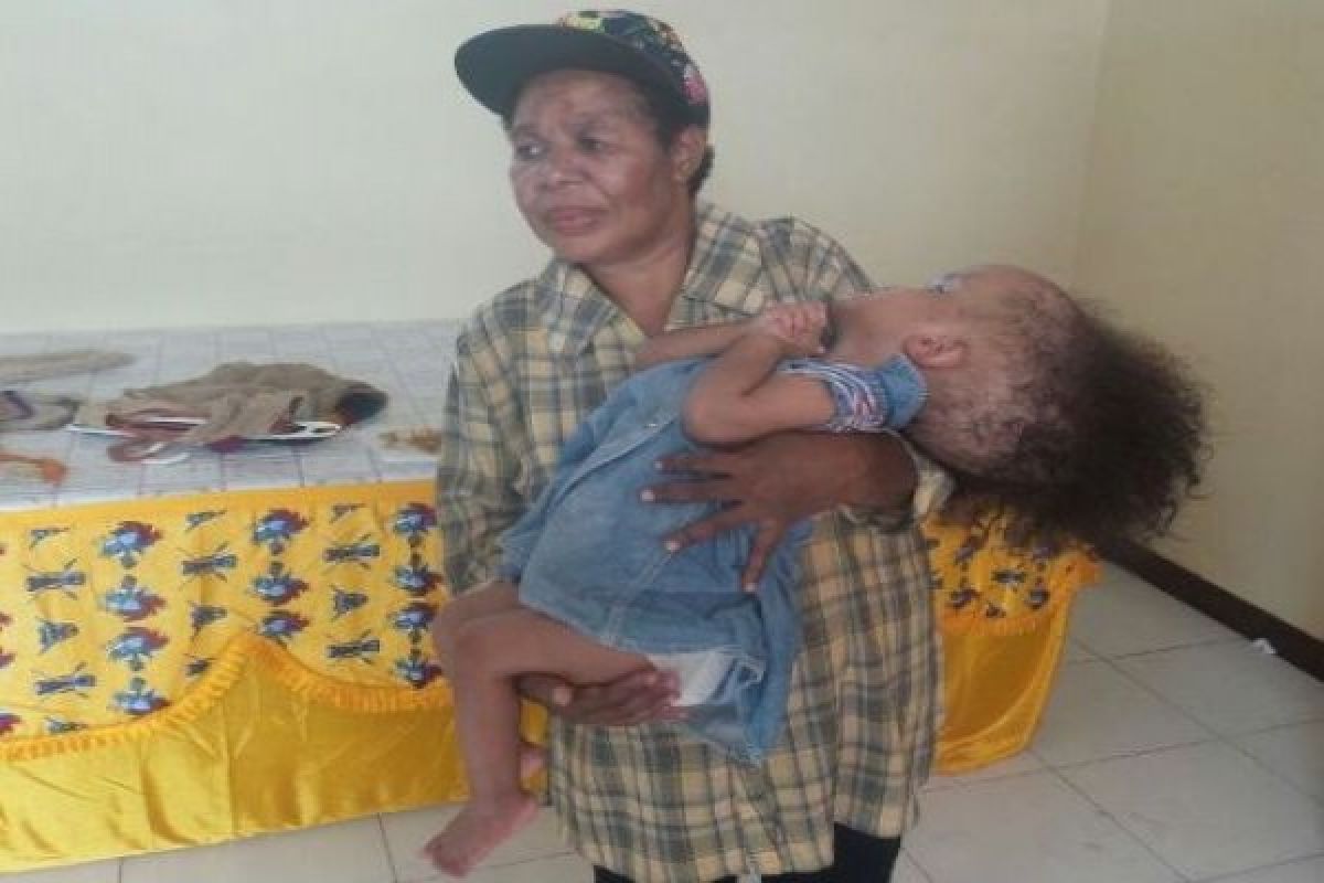 Keluarga penderita hidrosefalus tunda keberangkatan ke Jakarta 