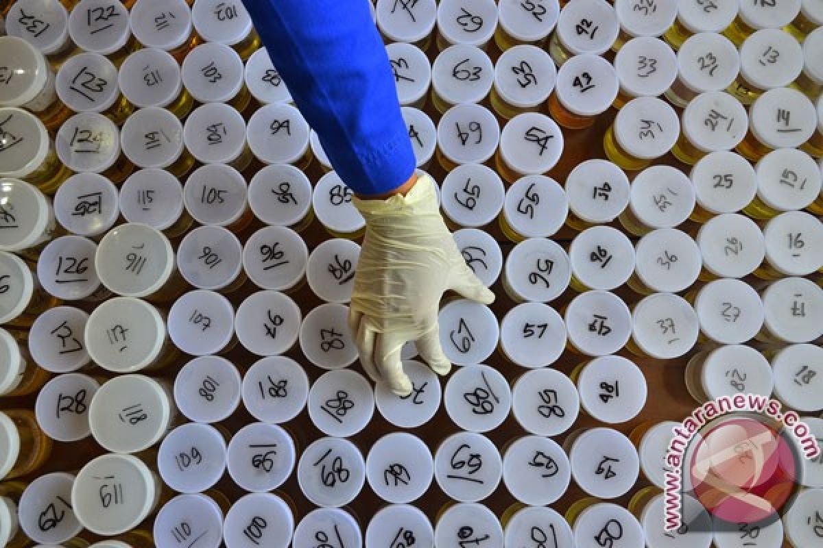 Pemeriksaan hormon di urine memudahkan diagnosis kelainan sistem reproduksi