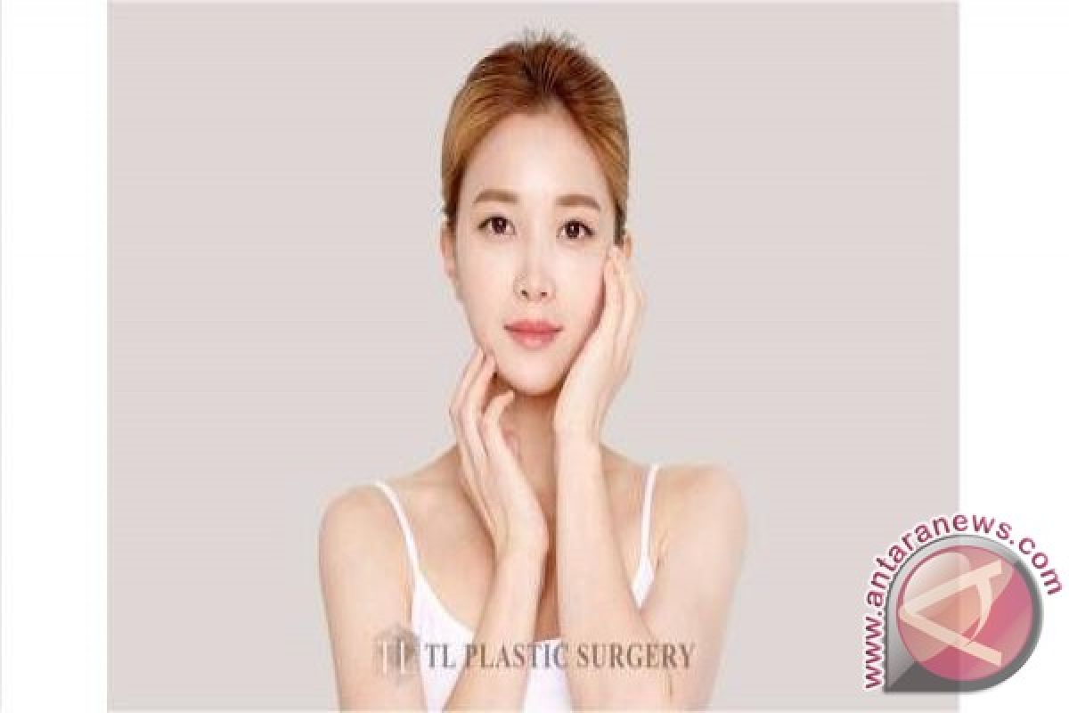 Rhinoplasty, the most affected by your facial impression, if the first surgery got failed, revision should be more cautious