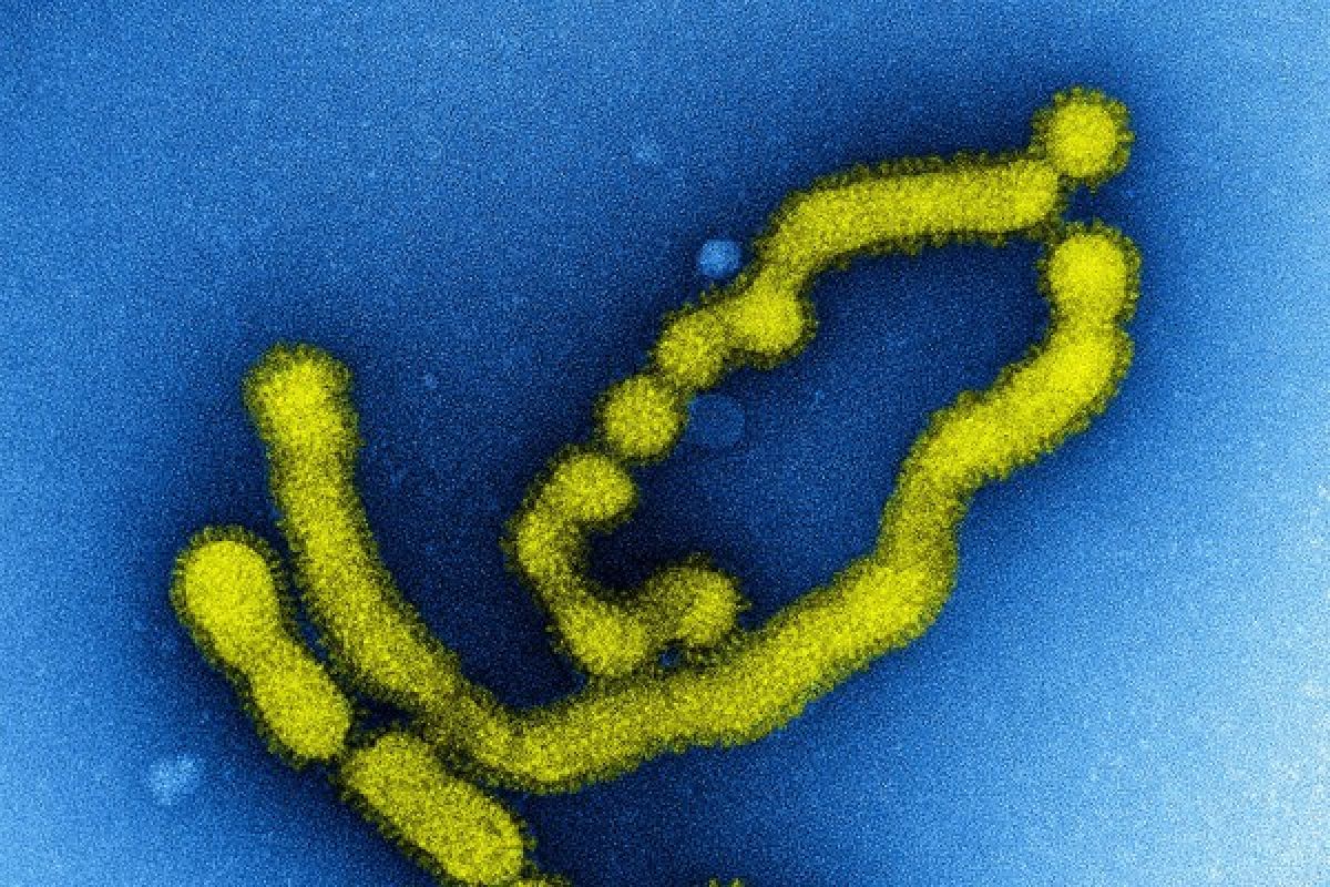 Empat orang lagi meninggal akibat wabah flu babi di Myanmar