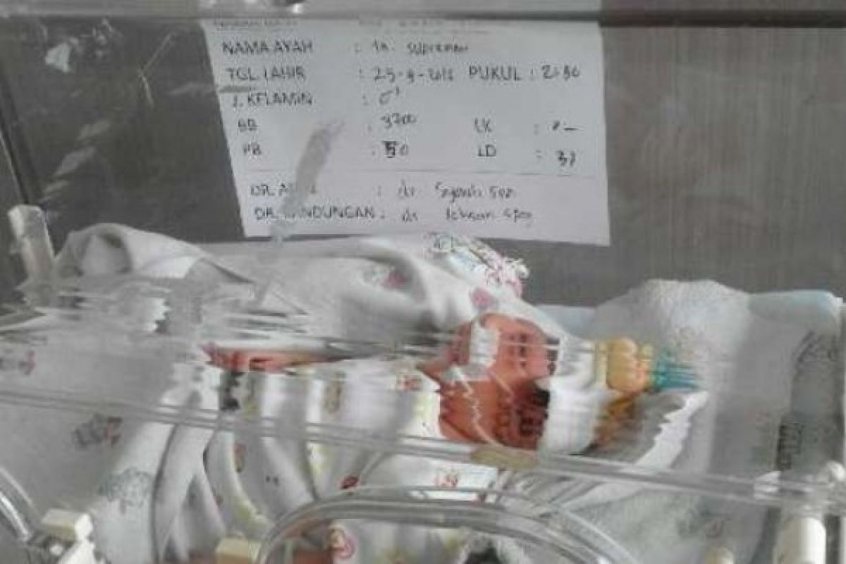 Bayi Tanpa tempurung Kepala Lahir Dengan Selamat