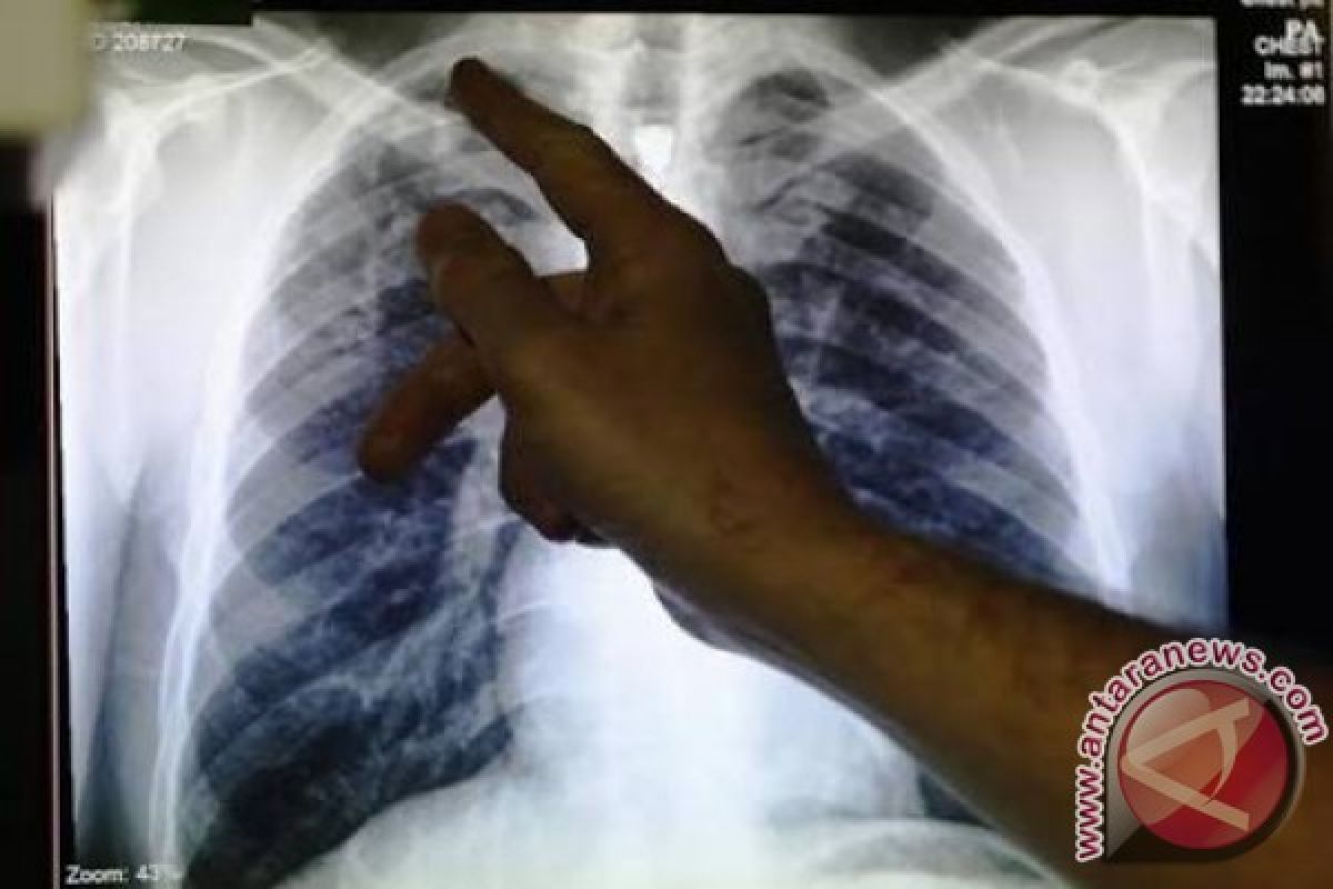 Dinkes Papua catat 6.394. kasus TB sepanjang 2017