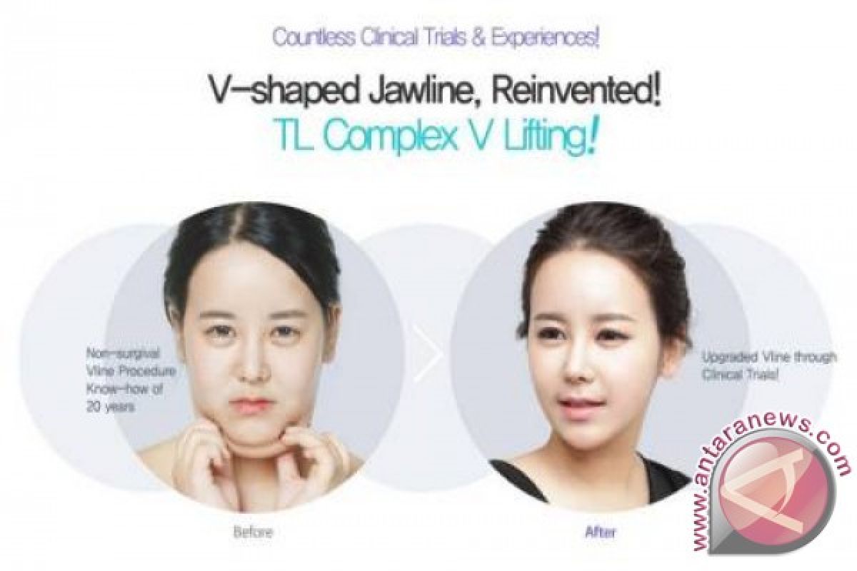 Dr Jung Yeon Ho's "TL POWER V Lift Non Surgical Facial Contouring" gets the fantastic V line shaped face without bone surgery!