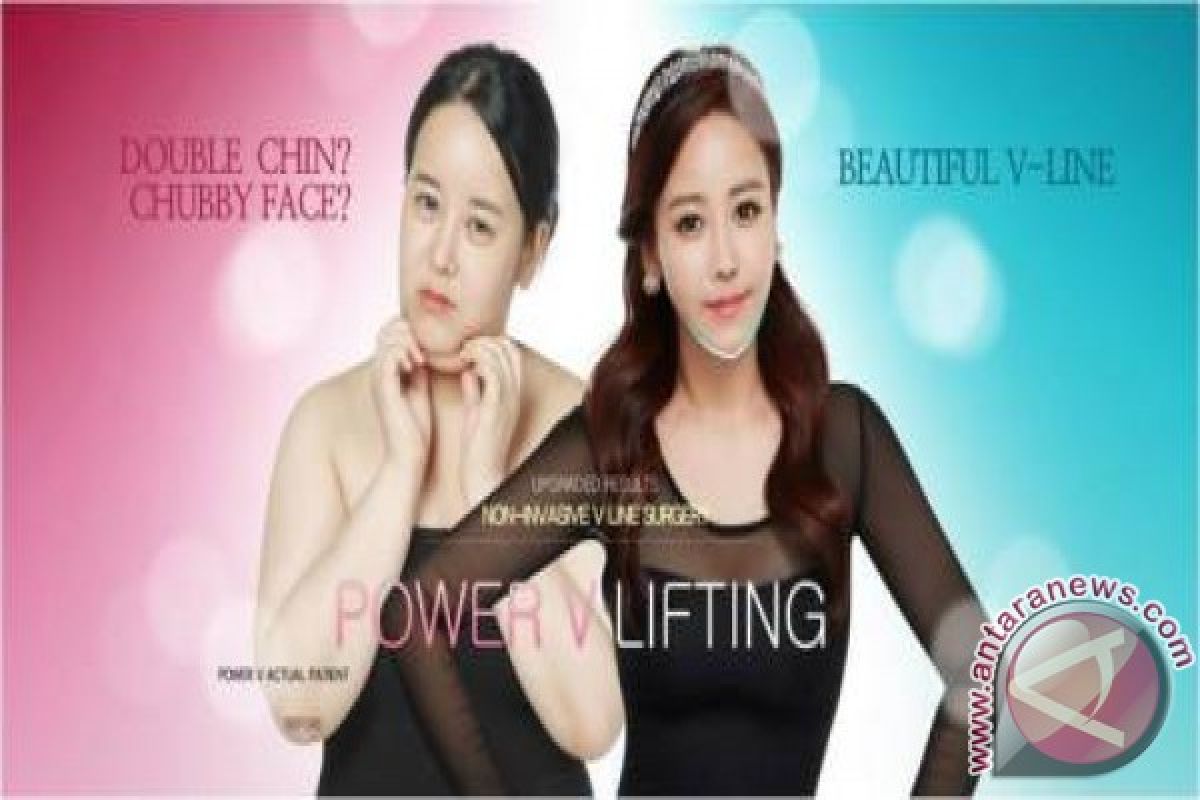 TL Plastic Surgery bantu Anda wujudkan wajah ramping berbentuk V dengan prosedur TL Power V Lift