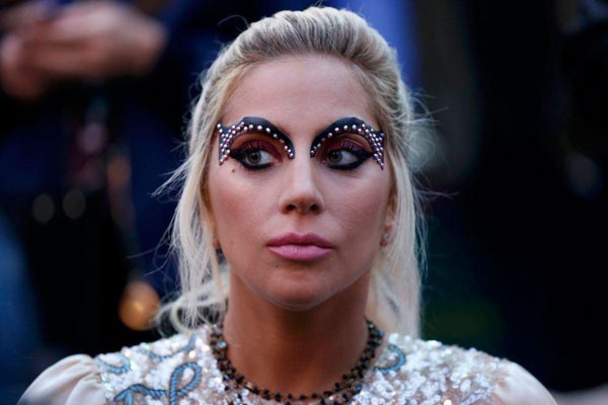 Lady Gaga pastikan kesehatannya membaik