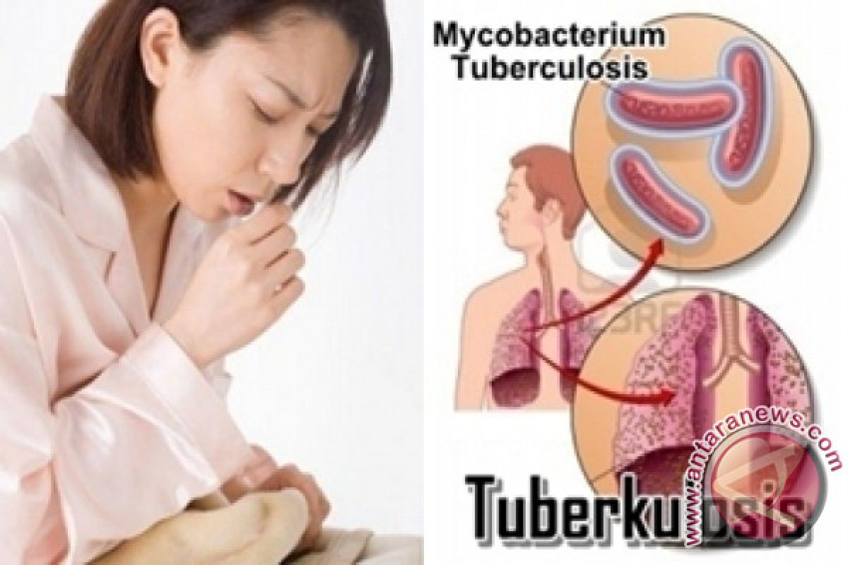Hari TB sedunia, pandemi COVID-19 belenggu kemajuan pengendalian Tuberkulosis