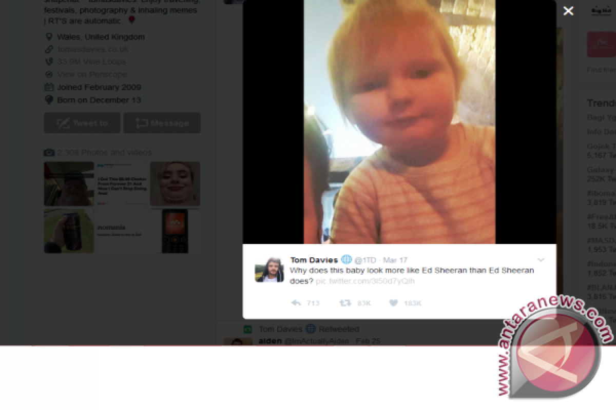 Lucu! Balita Ini Jadi Viral Karna Mirip Ed Sheeran