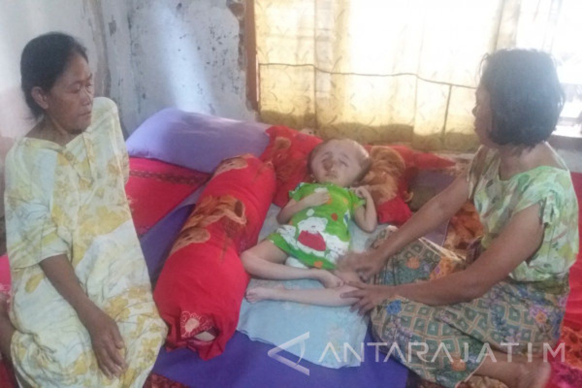 10 Tahun Penderita Hidrosefalus di Situbondo Terbaring (Video)