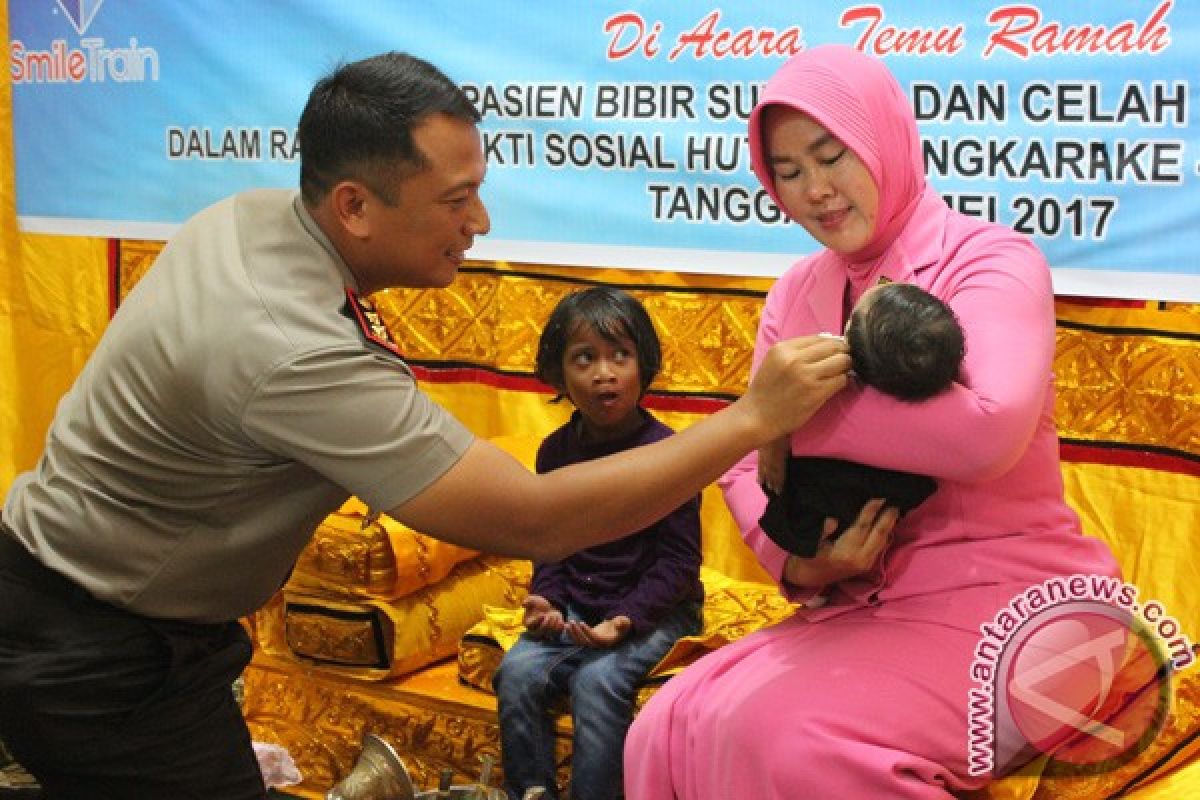 Polres Aceh Barat adakan operasi bibir sumbing