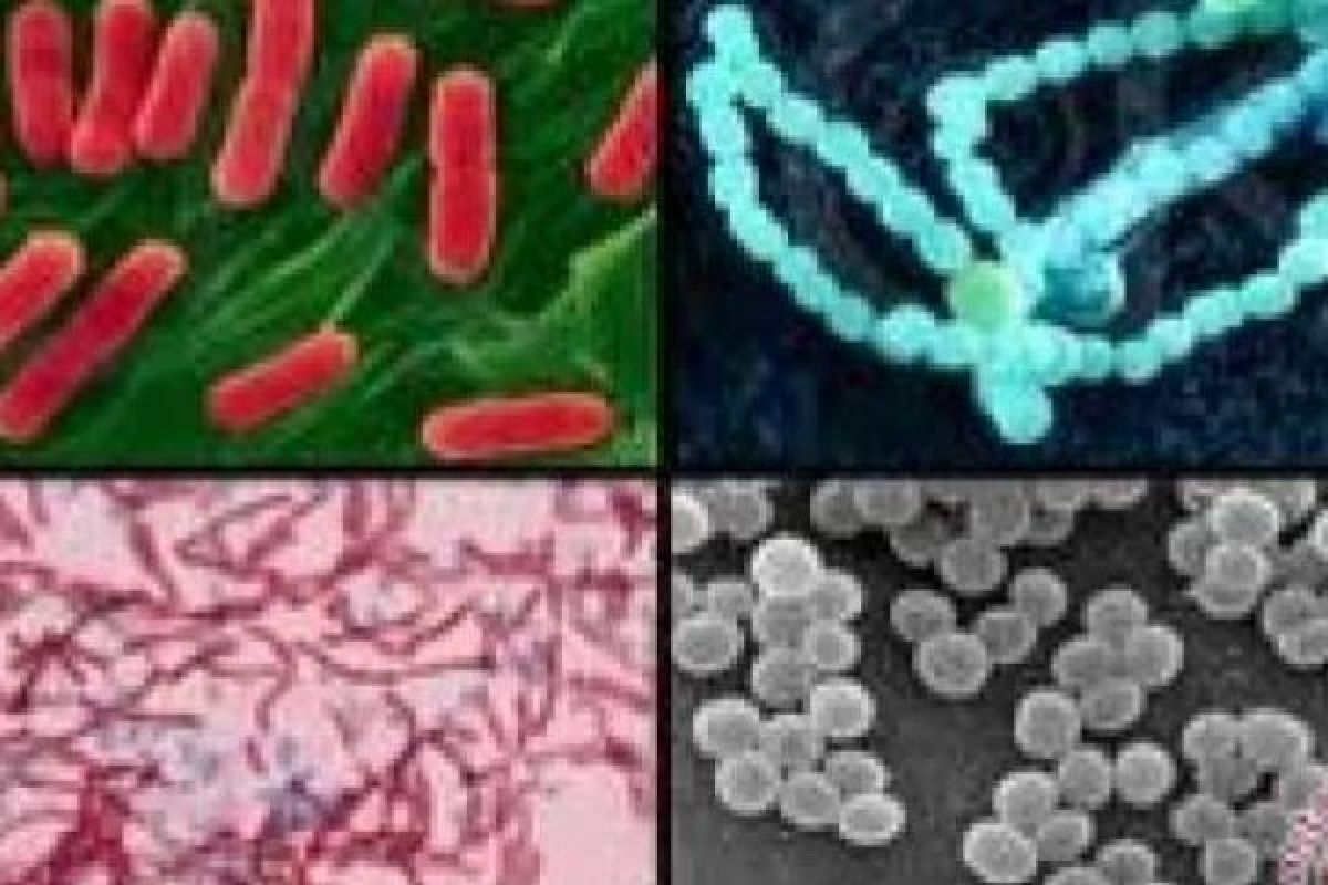 Mahasiswa Universitas Brawijaya Ciptakan Detektor Bakteri Salmonella