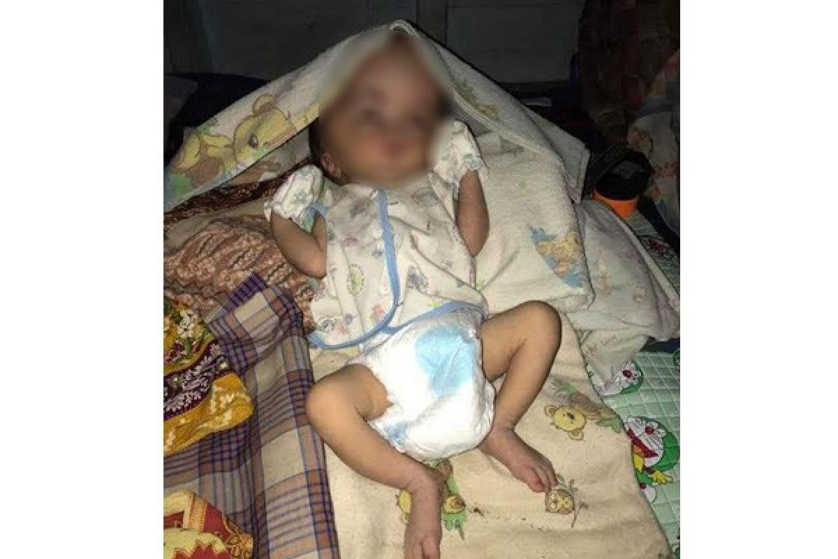 KNPI Barito Utara Galang Dana untuk Bayi Hidrosefalus 