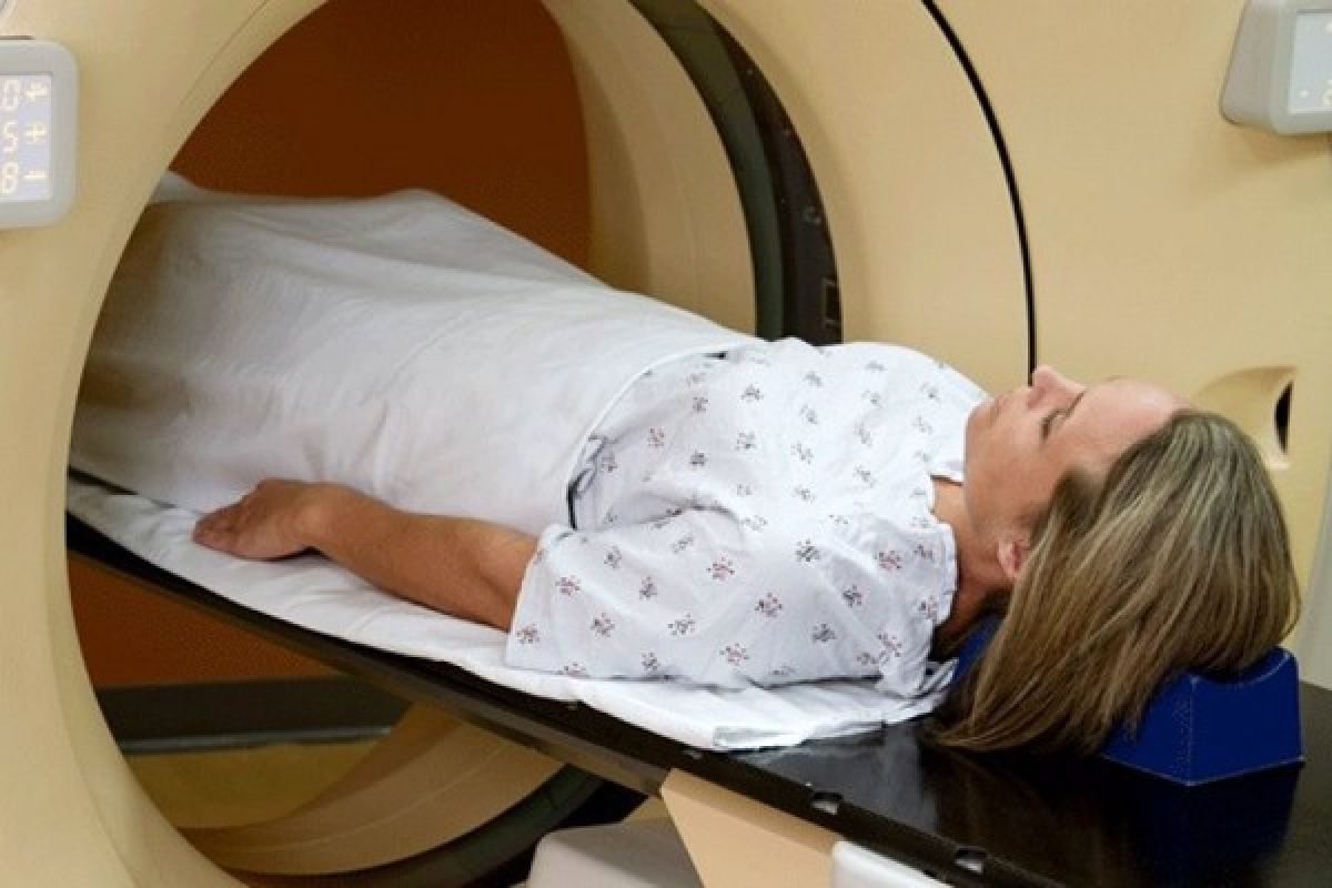 Dokter: Penanganan Kemoterapi Harus Lihat Manfaat-Risiko