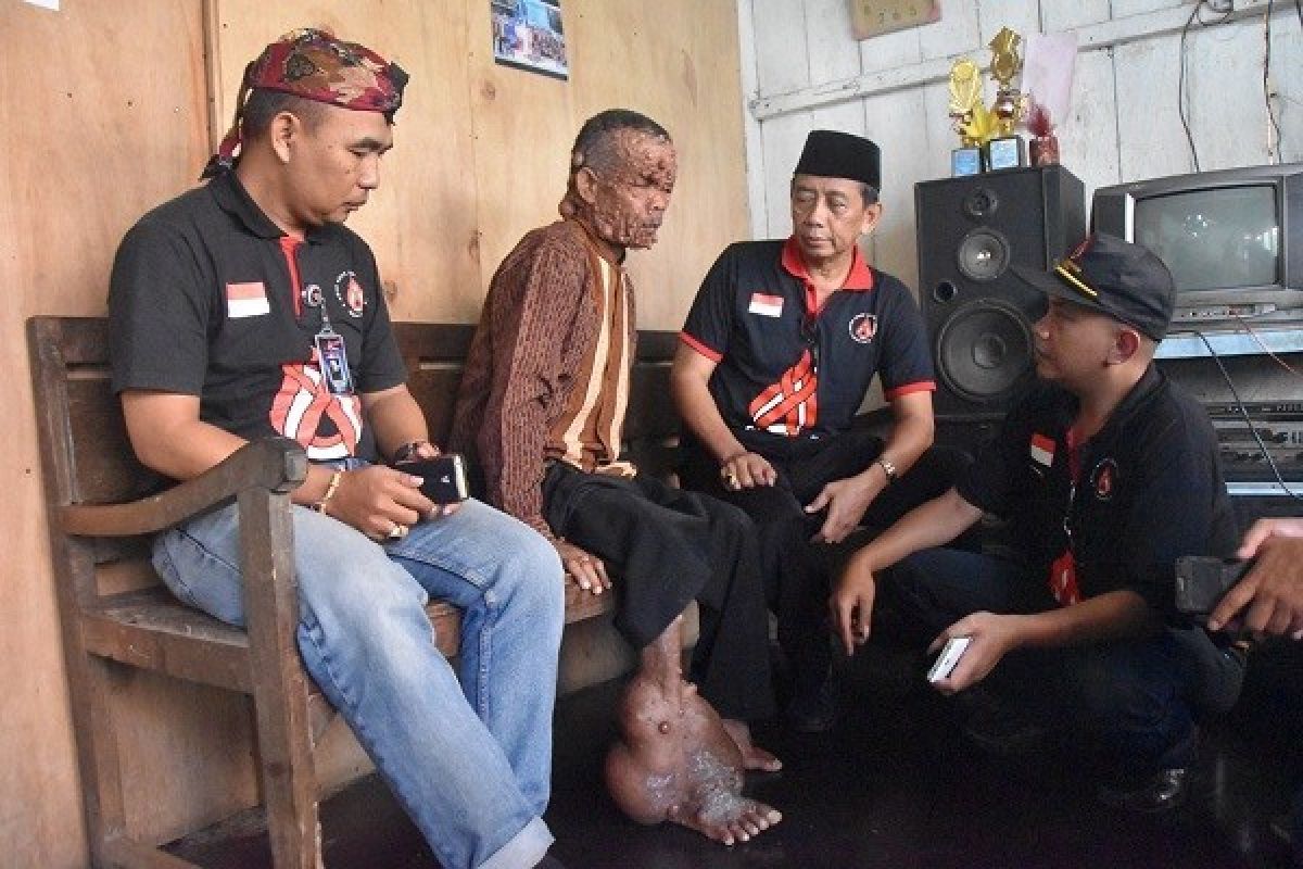 "Manusia pohon" Wonosobo tulang punggung keluarga