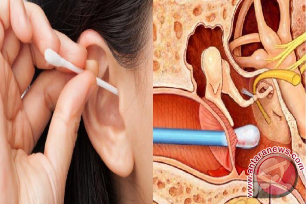 Dokter: Deteksi dini gangguan pendengaran penting demi kualitas hidup