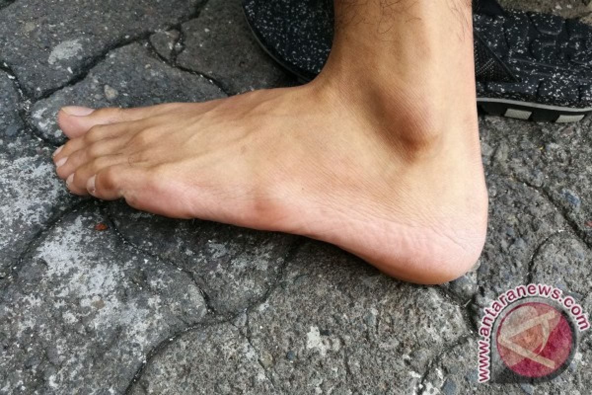 Kebiasaan sepele ini sebabkan tumit kaki bermasalah