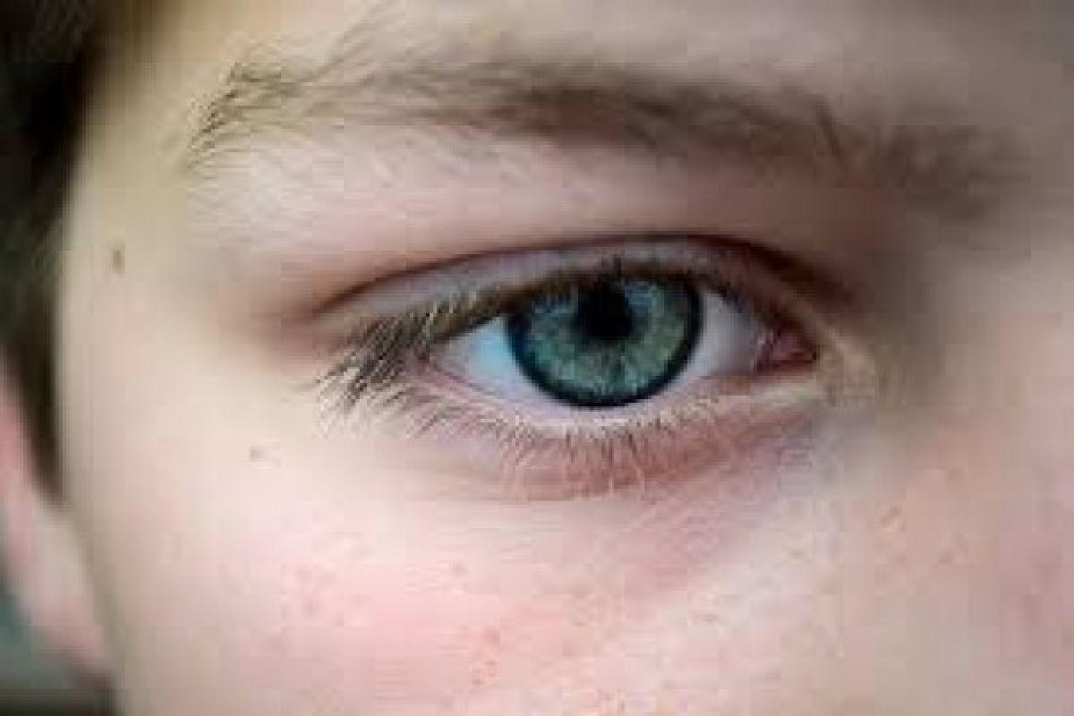 Cara gunakan lensa kontak agar terhindar dari infeksi mata