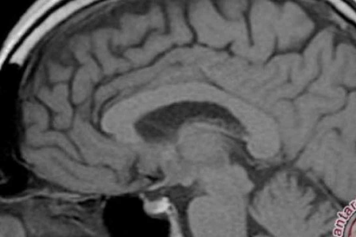  Wahh, Bentuk Otak Kita Semakin Berubah, Simak Hasil Penelitian ini