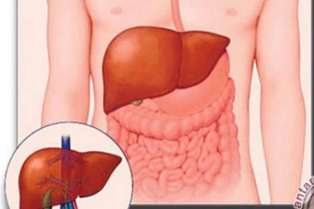 Yuk Mengenal Lebih Jauh Penyakit Hepatitis C dan Cara Penularannya