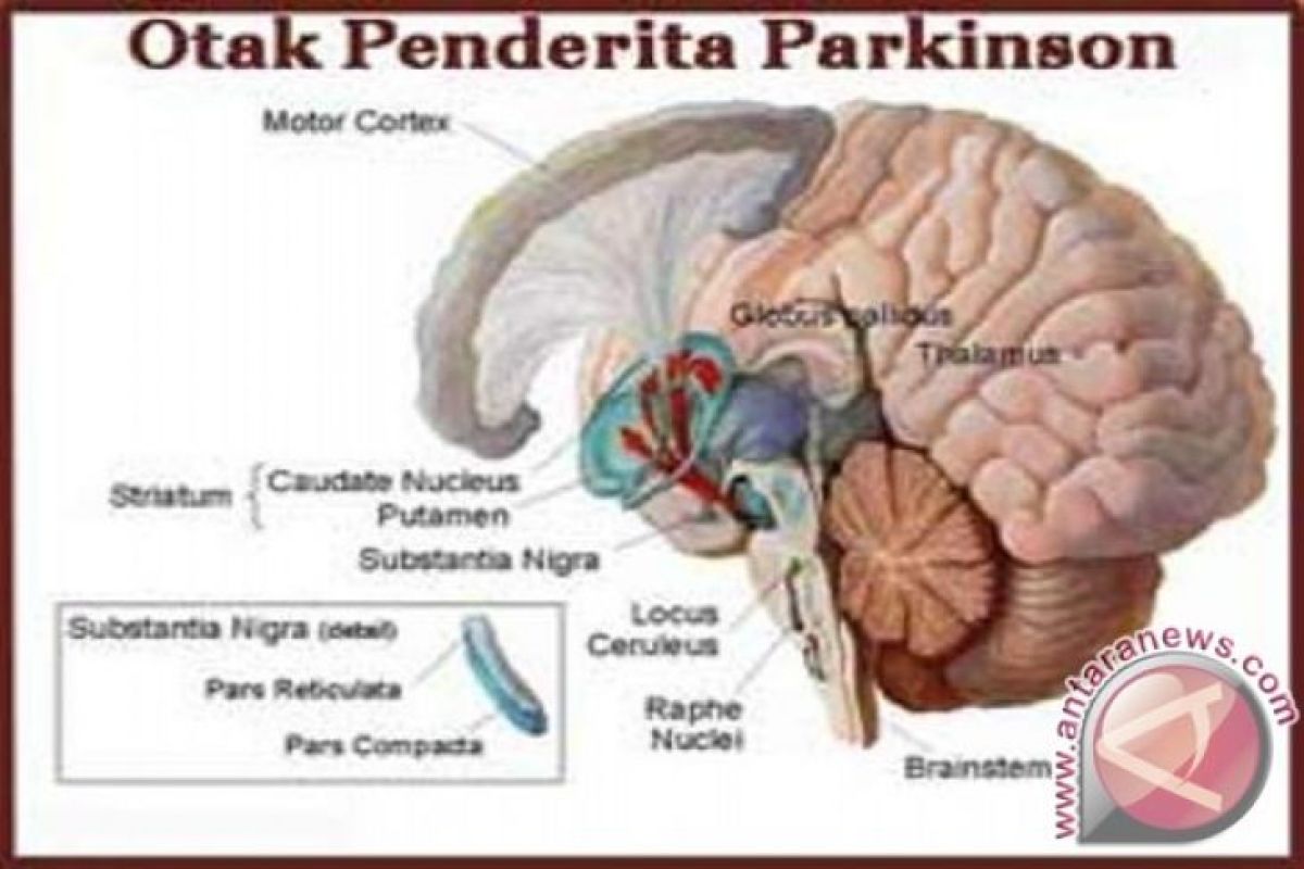 Penyakit Parkinson bisa didiagnosis melalui air mata
