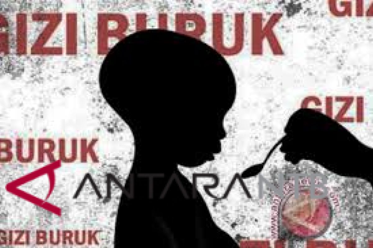 Dinkes Mataram tangani lima kasus gizi buruk