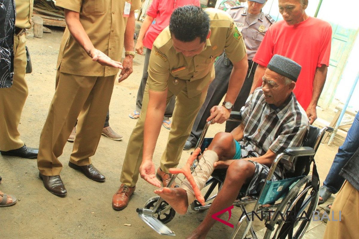 Pemkab Jembrana siapkan puluhan bantuan kursi roda