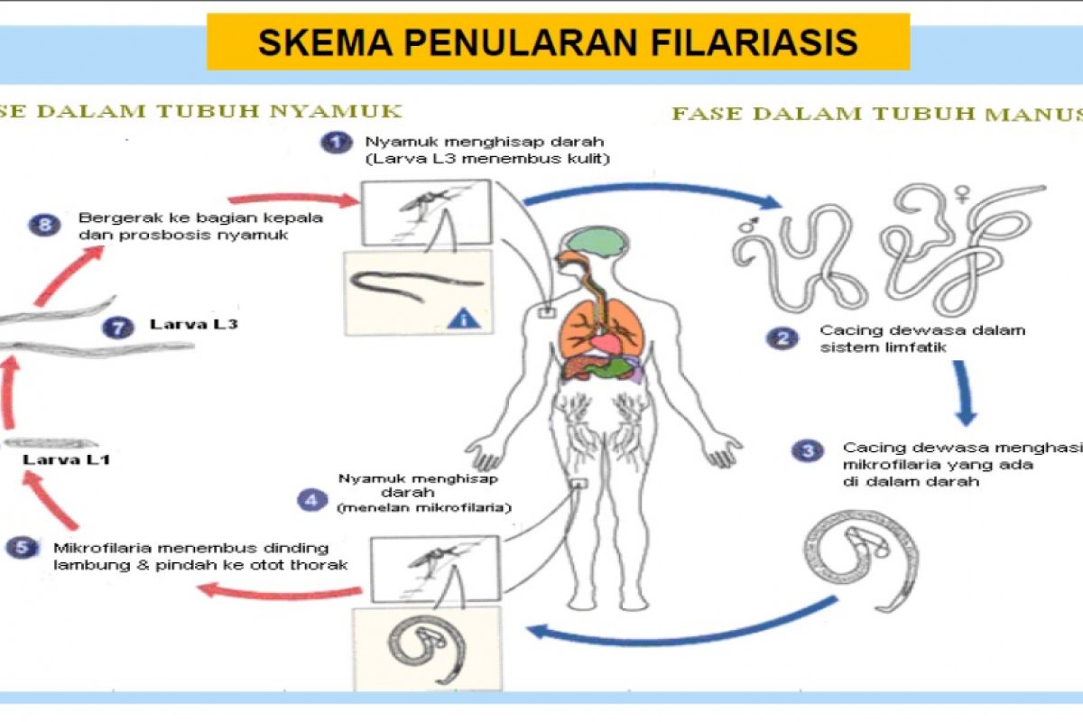 filariasis still common disease in indonesia