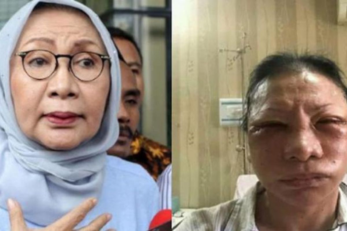 Dinilai buat kegaduhan, Ratna Sarumpaet akui tak ada penganiayaan