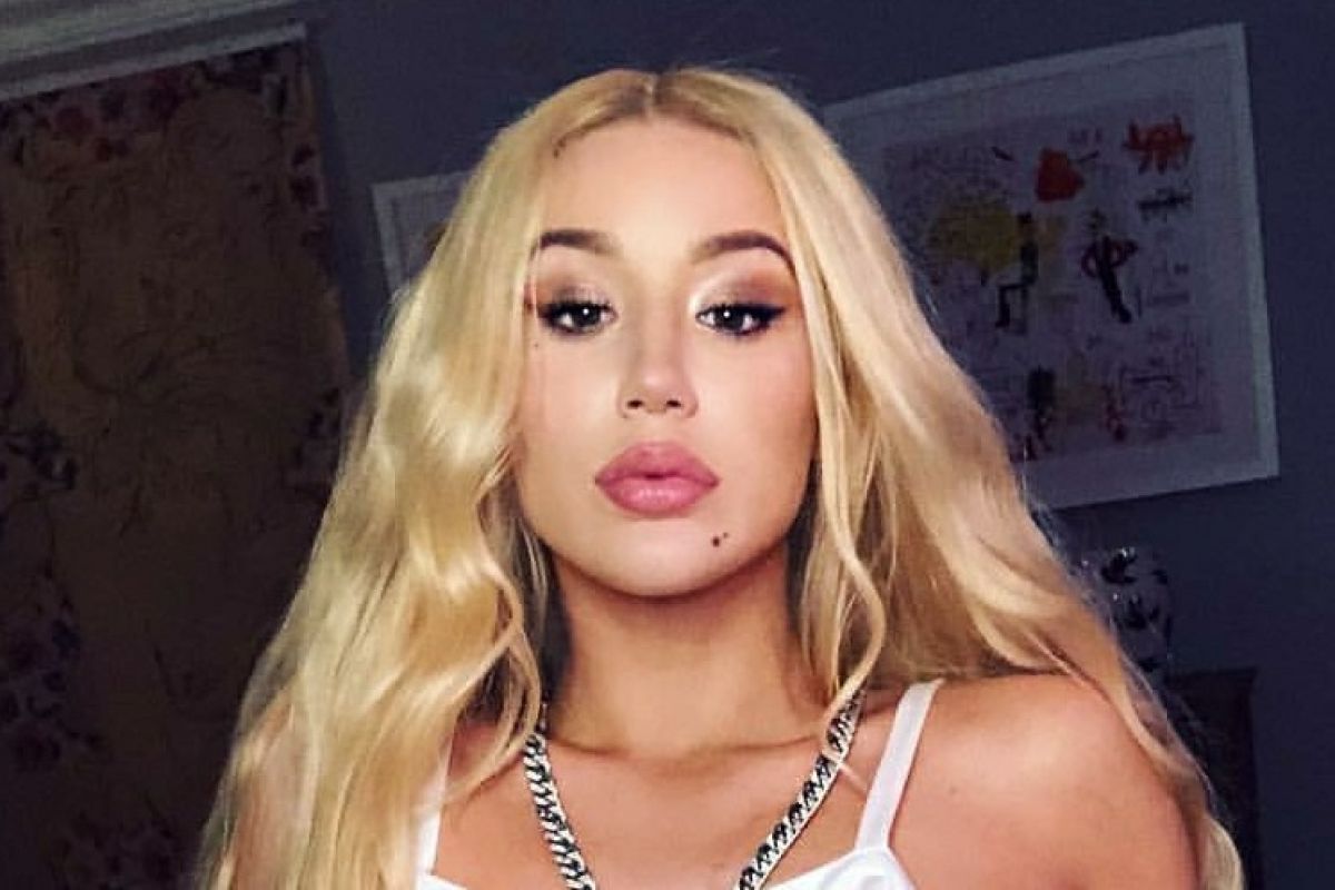 Iggy Azalea operasi plastik lagi