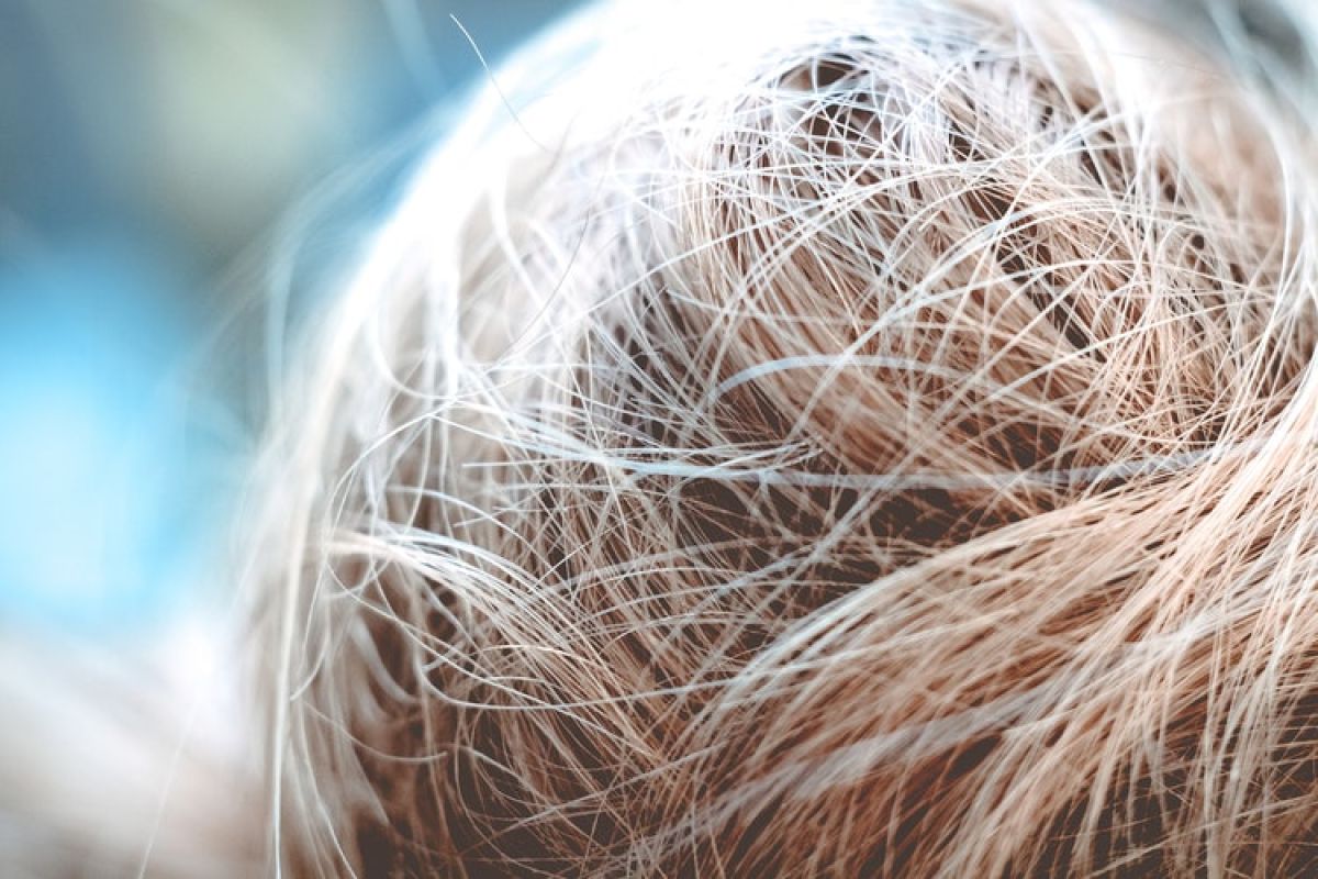 Apa penyebab rambut rusak di iklim tropis?