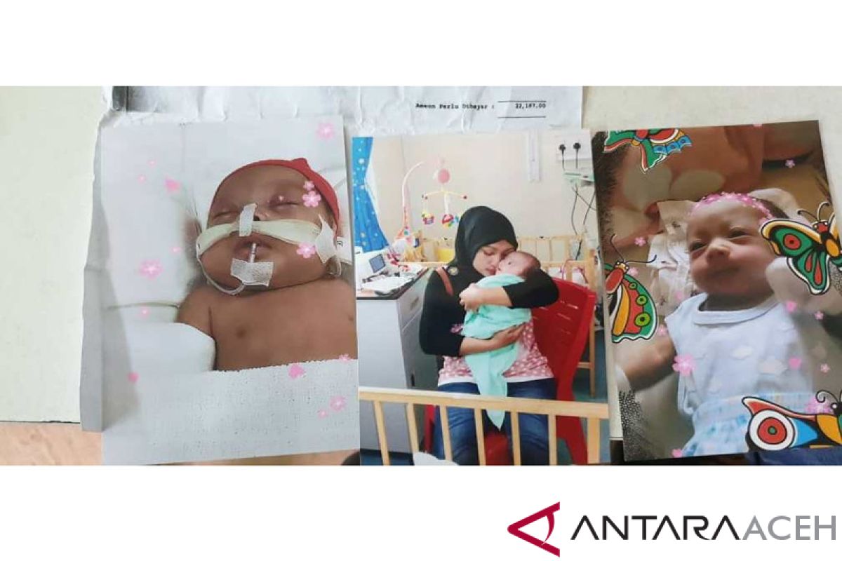 Pemkab Nagan Raya bantu keluarga bayi kembar di Malaysia